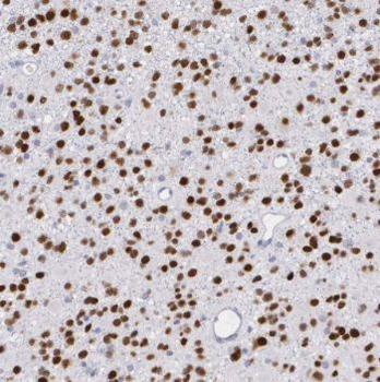 PMP2 Antibody