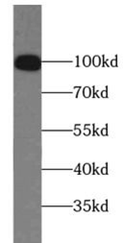 PMS2 Antibody