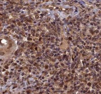 PMS2 Antibody