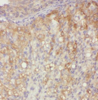 PNCK Antibody