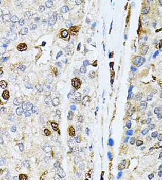 PNKP Antibody