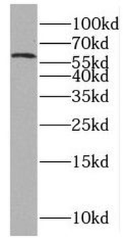 PNLDC1 Antibody