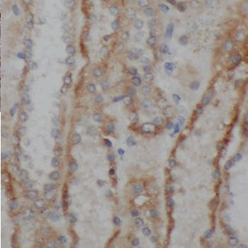 PNLDC1 Antibody