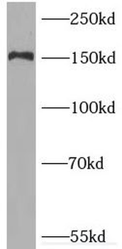 PNPLA6 Antibody