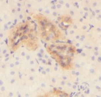 PODXL Antibody