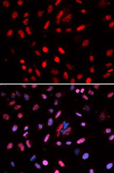 POLD1 Antibody
