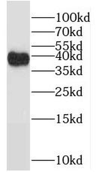 POLDIP2 Antibody