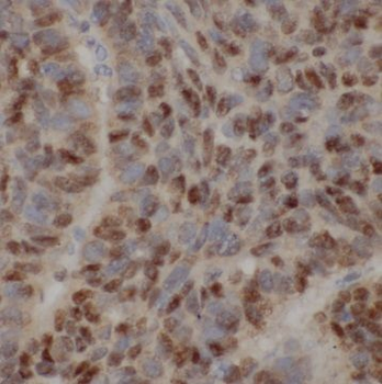 POLE3 Antibody