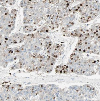 POLI Antibody