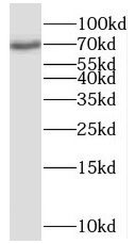 POLK Antibody