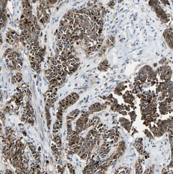 POLK Antibody