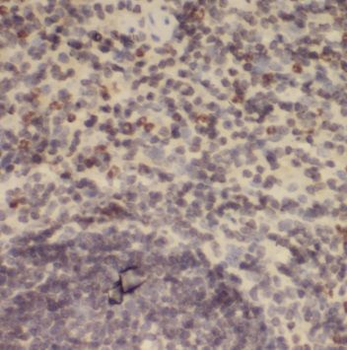 POLM Antibody