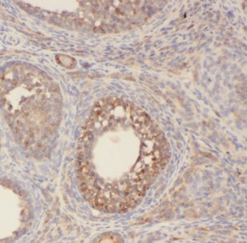 POLR1C Antibody