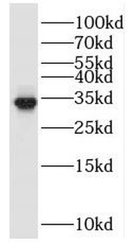 POLR2C Rabbit Polyclonal Antibody