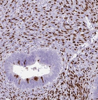 POLR2C Rabbit Polyclonal Antibody
