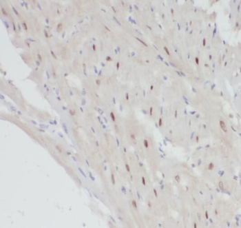 POLR2J Antibody