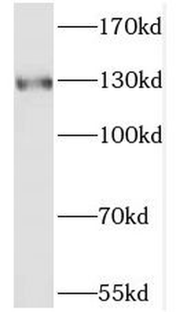 POLR3B Antibody