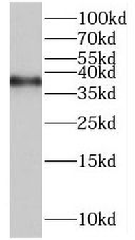 POLR3F Antibody