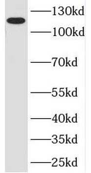 POP1 Rabbit Polyclonal Antibody