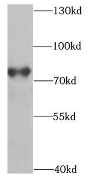 POT1 Antibody