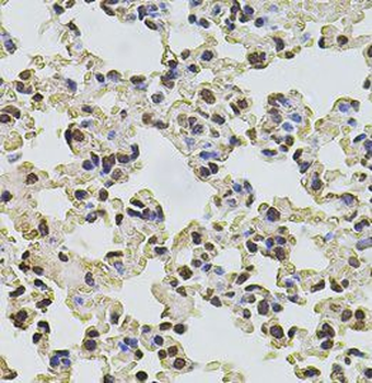POT1 Antibody