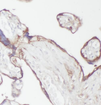PPA2 Antibody