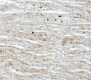 PPARA Antibody