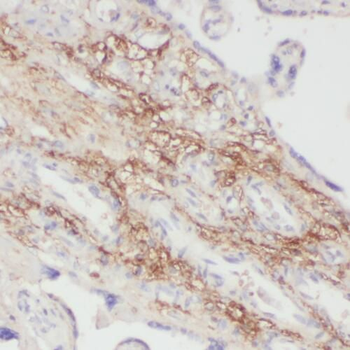 PPBP Antibody