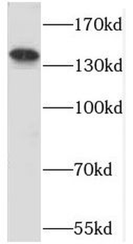 PPFIA3 Rabbit Polyclonal Antibody