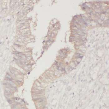 PPFIBP1 Antibody