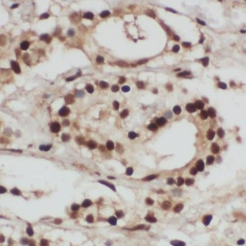 PPIG Antibody