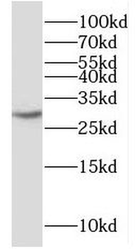 PPIL6 Rabbit Polyclonal Antibody