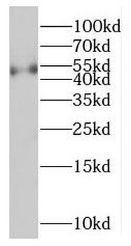 PPM1F Rabbit Polyclonal Antibody