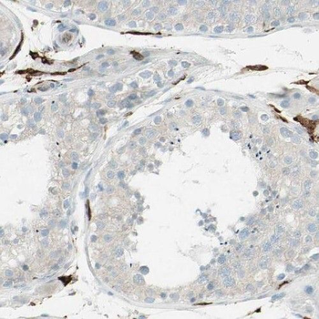 PPM1G Antibody