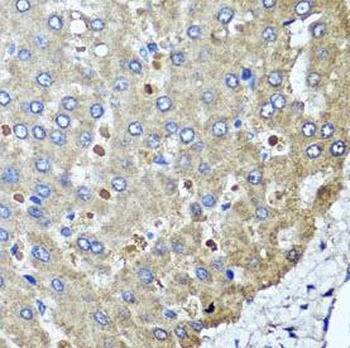 PPOX Antibody
