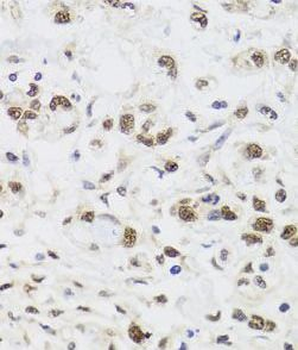 PPP1CC Antibody