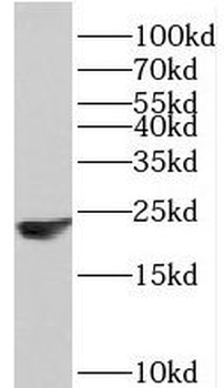 PPP1R14B Antibody