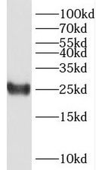 PPP1R14D Rabbit Polyclonal Antibody