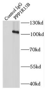 PPP1R15B Antibody