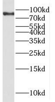 PPP1R3F Antibody