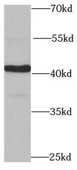 PPP1R8 Antibody