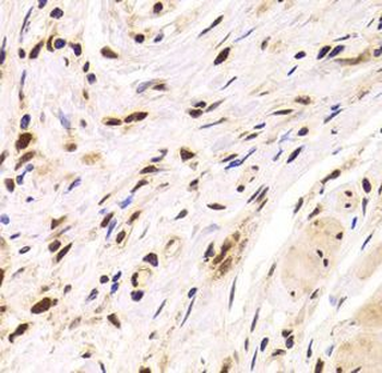 PPP1R8 Antibody