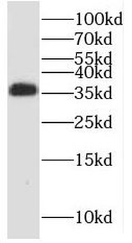 PPP2CB Rabbit Polyclonal Antibody