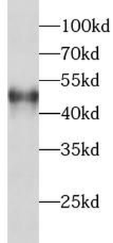 PPP2R2B Antibody