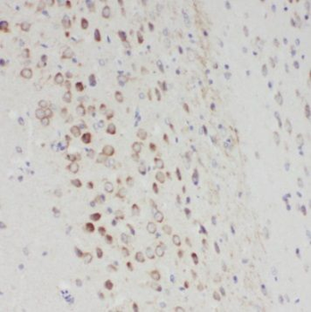 PPP2R3A Antibody