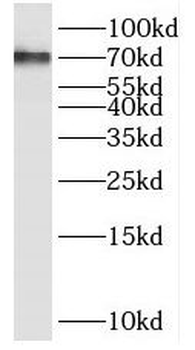 PPP2R5D Antibody