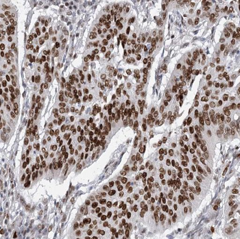 PPP2R5E Antibody