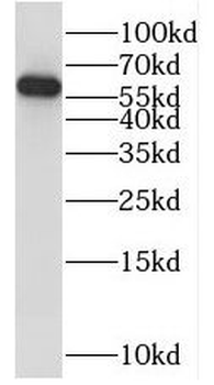 PPP3CB Antibody