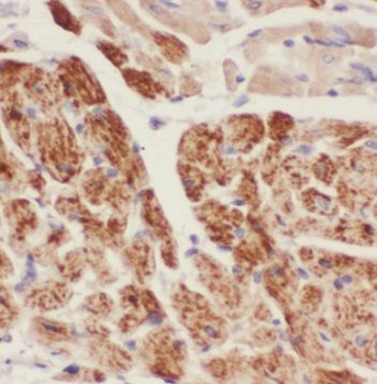 PPP3CB Antibody