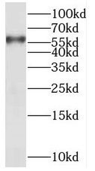 PPP3CC Rabbit Polyclonal Antibody